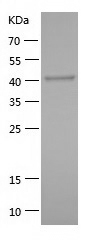 Recombinant Human DNAJA1/人源DNA