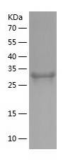 Recombinant Human JMJD7/人源JMJD