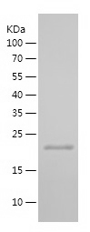 Recombinant Human CDKN2A/人源CDK
