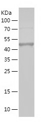 Recombinant Human RIOK1/人源RIOK
