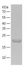 Recombinant Human N6AMT1/人源N6A