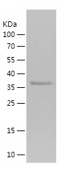 Recombinant Human CNDP1/人源CNDP