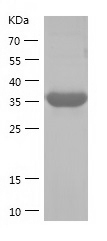 Recombinant Human USP46/人源USP4