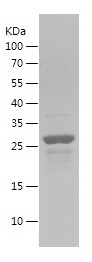 Recombinant Human AXIN1/人源AXIN