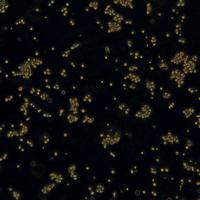 浙江美森-人结直肠腺癌细胞 COLO 320HSR(Luc1)现货