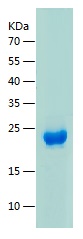 Recombinant Human GRPEL1/人源GRP
