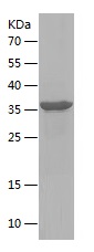 Recombinant Human NKp44/人源NKp4
