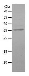 Recombinant Human FKBP1A/人源FKB