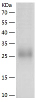 Recombinant Human Ephrin-A1/人源