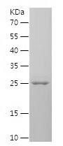 Recombinant Human CEP63/人源CEP6