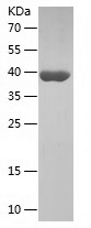 Recombinant Human KMT5A/人源KMT5