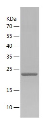 Recombinant Human TFPI-2/人源TFP