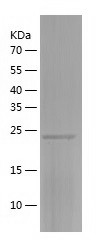 Recombinant Human ZC4H2/人源ZC4H