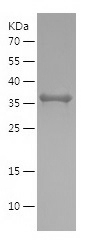 Recombinant Human ATP5F1D/人源AT