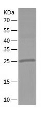 Recombinant Human METTL1/人源MET