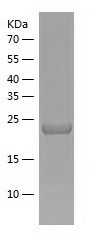 Recombinant Human NRIP3/人源NRIP
