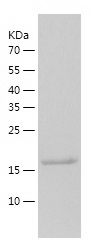 Recombinant Human Ube2H/人源Ube2
