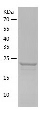 Recombinant Human PSMA8/人源PSMA