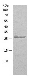Recombinant Human ZNF184/人源ZNF