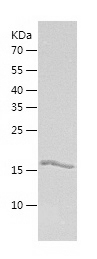 Recombinant Human Ube2G1/人源Ube