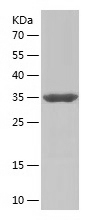 Recombinant Human TIMM9/人源TIMM