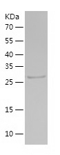 Recombinant Human PSME3/人源PSME