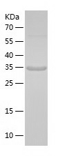 Recombinant Human Olig2/人源Olig