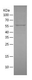 Recombinant Human PGM1/人源PGM1蛋