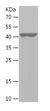 Recombinant Human LIG4/人源LIG4蛋