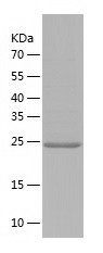 Recombinant Human Dnmt3L/人源Dnm