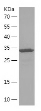 Recombinant Human AFAP1/人源AFAP