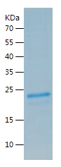 Recombinant Human TNFRSF1B/人源T
