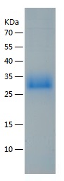 Recombinant Human ANGPTL3/人源AN