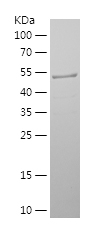 Recombinant Human PGM2/人源PGM2蛋