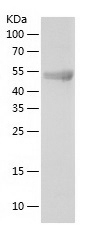 Recombinant Human TOR1AIP2/人源T
