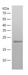Recombinant Human ATG10/人源ATG1