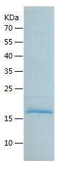 Recombinant Human LECT2/人源LECT