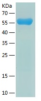 Recombinant Human LRG1/人源LRG1蛋