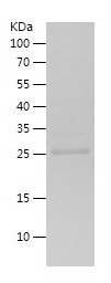 Recombinant Human EDN1/人源EDN1蛋