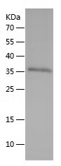 Recombinant Human LDHB/人源LDHB蛋