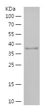 Recombinant Human RPP21/人源RPP2