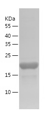 Recombinant Human ITPKB/人源ITPK