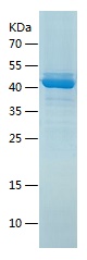 Recombinant Human CKMT1A/人源CKM