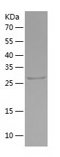 Recombinant Human CUEDC2/人源CUE