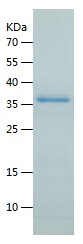 Recombinant Human DNTTIP1/人源DN