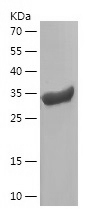 Recombinant Human SSNA1/人源SSNA