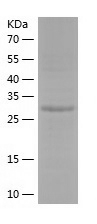 Recombinant Human ALKBH2/人源ALK