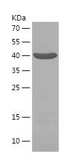Recombinant Human INPP5D/人源INP