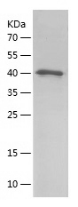 Recombinant Human RPGRIP1L/人源R