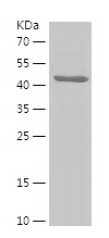 Recombinant Human PDE6B/人源PDE6